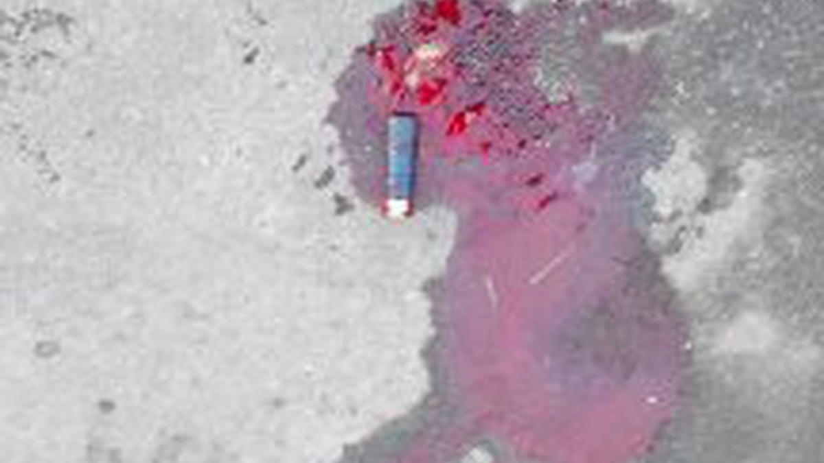 Man Kills Doctor During Medical Examination Kyiv TCK
