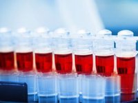 В Україні відзначається низький рівень діагностування споріднених із гемофілією захворювань - пацієнти