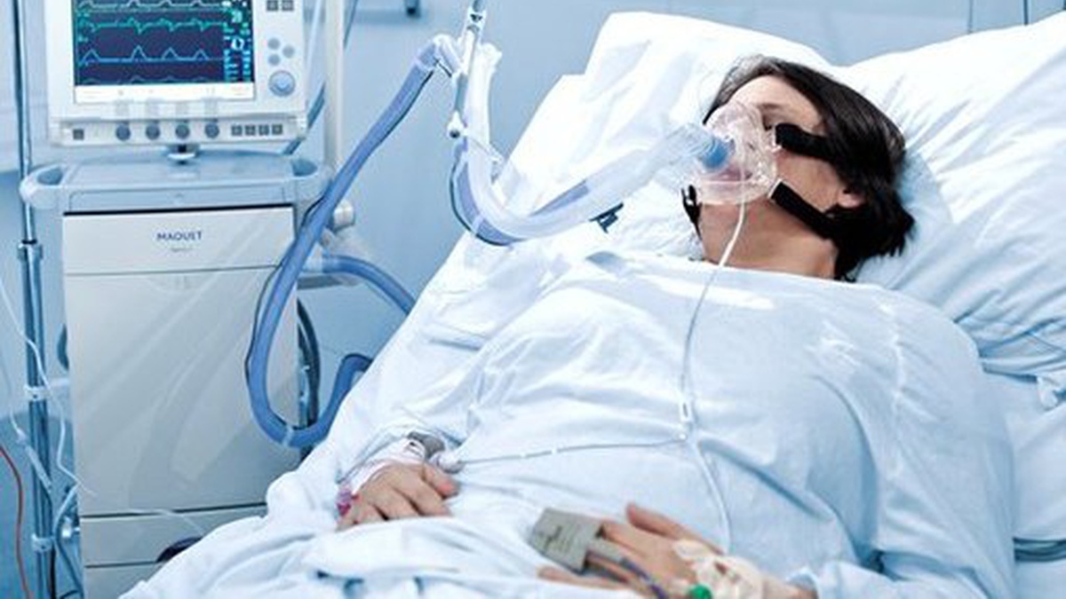Інститут Амосова за сприяння посольства України в Італії отримав 5 апаратів штучної вентиляції легень