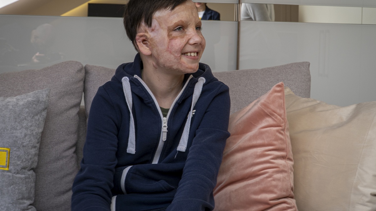 Незламний Роман Олексів, який вижив після обстрілу Вінниці у 2022 році, отримав власну квартиру від Ріната Ахметова