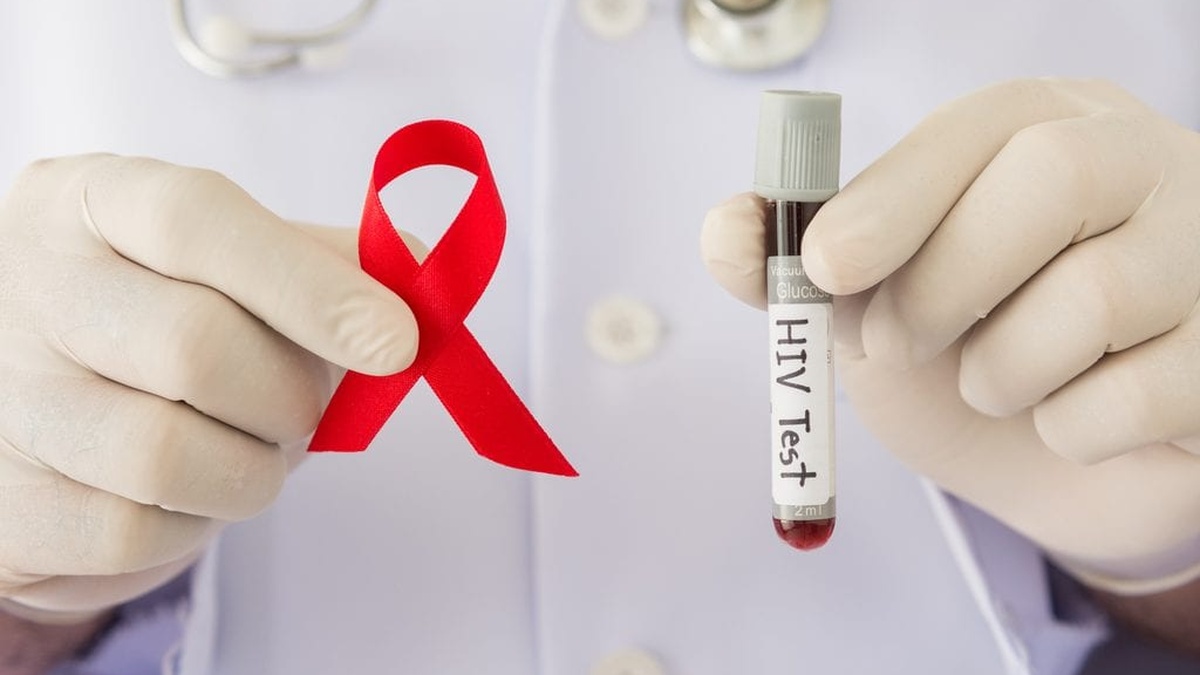 Кількість людей, що живуть з ВІЛ, з 2022р скоротилася на 15 тис. – БО 